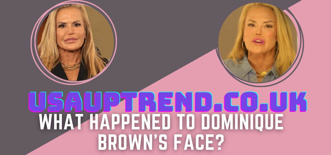 Dominique Brown Plastic Surgery