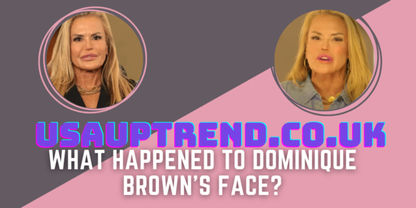 Dominique Brown Plastic Surgery