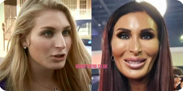 Laura Loomer’s plastic surgery