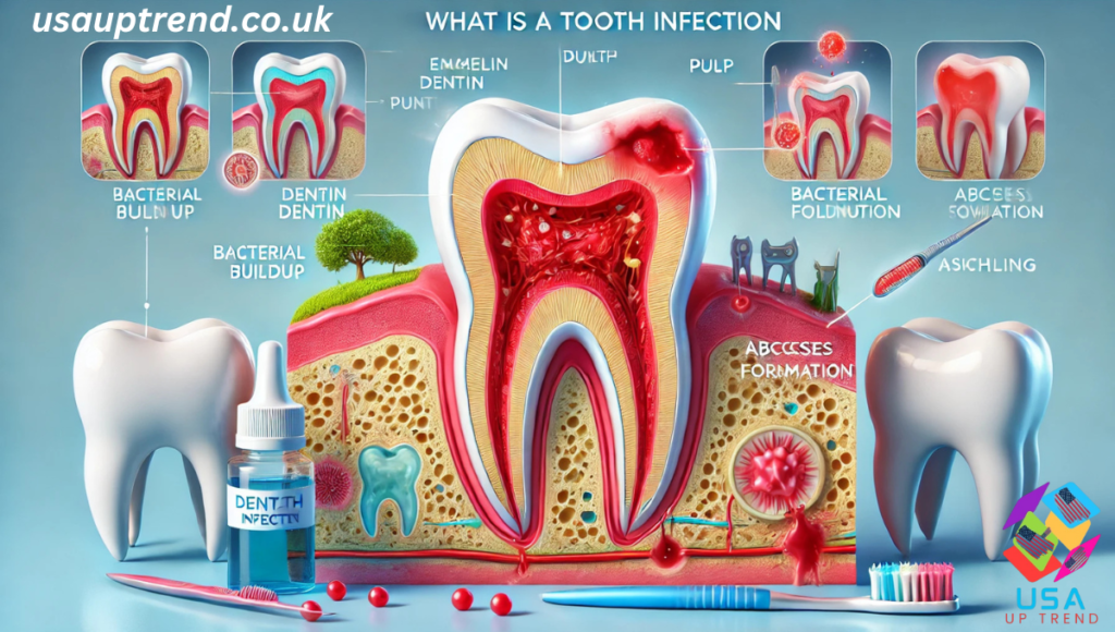 What is a Tooth Infection?